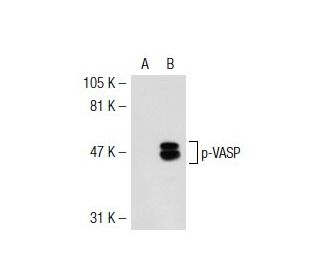 p-VASP (Ser 239): sc-23507. Western blot analysis of VASP phosphorylation... 