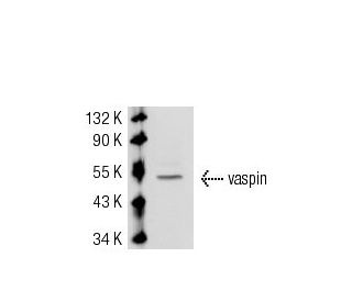 vaspin Antibody (1C4) - Western Blotting - Image 53702 