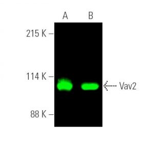 Vav2 Antibody (F-6) - Western Blotting - Image 389755 