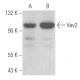 western blotting image from recommended Vav2 (F-6) monoclonal antibody replacement. Image 355667