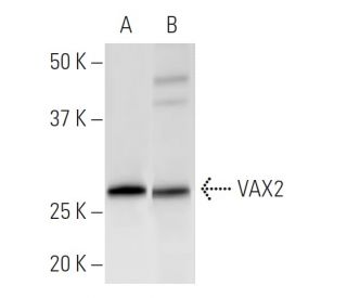 VAX2 Antibody (VAX2A8F12) - Western Blotting - Image 399591Each CRISPR/Cas9 Knockout (KO) Plasmid product consists of a pool of 3 plasmids designed to ensure identification and cleavage of a specific gene for maximum knockout efficiency. Each plasmid encodes a unique 20 nt sequence derived from the GeCKO (v2) library.