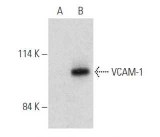 western blotting image from recommended VCAM-1 (E-10) monoclonal antibody replacement. Image 356962