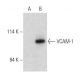 western blotting image from recommended VCAM-1 (E-10) monoclonal antibody replacement. Image 356962