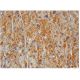 VCAM-1 Antibody (P3C4) - Immunohistochemistry - Image 284766 
