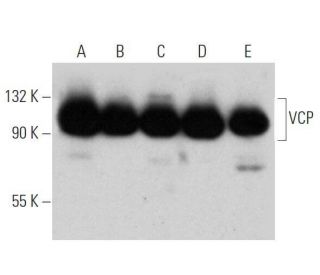 VCP Antibody (5) - Western Blotting - Image 355288 