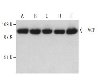 VCP Antibody (5) - Western Blotting - Image 397624