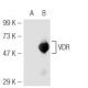 VDR (D-6): sc-13133. Western blot analysis of VDR expression in...