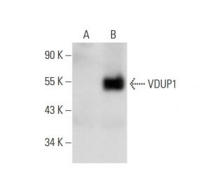 VDUP1 Antibody (B-2) - Western Blotting - Image 70353 