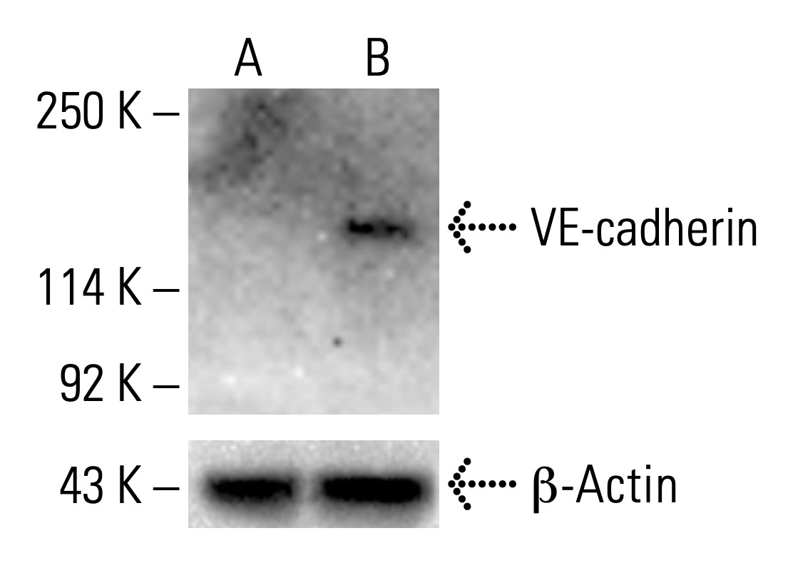 M▽エリザベス・オニール・ヴァーナー (37889) BV421 Mouse Anti-Human TCR Vβ9