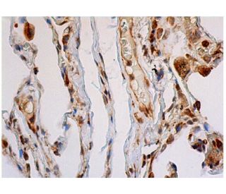 immunohistochemistry image from recommended VEGF (C-1) monoclonal antibody replacement. Image 348039