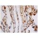 immunohistochemistry image from recommended VEGF (C-1) monoclonal antibody replacement. Image 348039