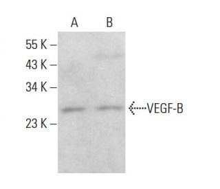 western blotting image from recommended VEGF-B (56-1) monoclonal antibody replacement. Image 381326