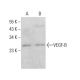 This polyclonal antibody has been discontinued. See our recommended <a href="vegf-b-antibody-56-1">VEGF-B (56-1)</a> monoclonal antibody (sample data shown). western blotting image from recommended VEGF-B (56-1) monoclonal antibody replacement. Image 381326