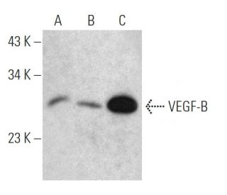 VEGF-B抗体 (RM0008-6E72) | SCBT - Santa Cruz Biotechnology