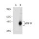 western blotting image from recommended VEGF-D (C-12) monoclonal antibody replacement. Image 146807