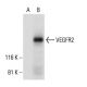 Flk-1/KDR/VEGFR2 Antibody (F-10) - Western Blotting - Image 292946 