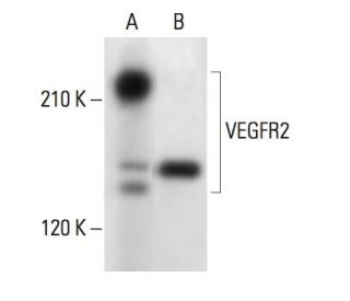 Flk-1/KDR/VEGFR2 Antibody (F-10) - Western Blotting - Image 304381 