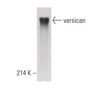 versican Antibody (4C5) - Western Blotting - Image 399650Each CRISPR/Cas9 Knockout (KO) Plasmid product consists of a pool of 3 plasmids designed to ensure identification and cleavage of a specific gene for maximum knockout efficiency. Each plasmid encodes a unique 20 nt sequence derived from the GeCKO (v2) library.