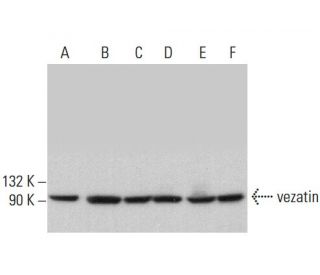 vezatin Antibody (B-1) - Western Blotting - Image 379480 