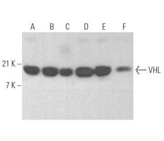 western blotting image from recommended Von Hippel Lindau/VHL (VHL40) monoclonal antibody replacement. Image 353345