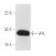 Von Hippel Lindau/VHL Antibody (G-7) - Western Blotting - Image 428