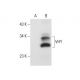 VHY Antibody (G-7) - Western Blotting - Image 72321 