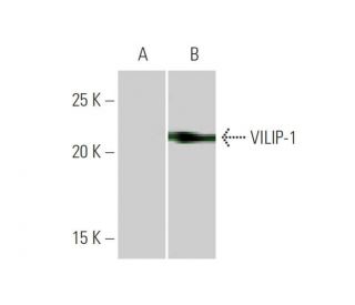 VILIP-1 Antibody (2F1-E3) - Western Blotting - Image 347586 