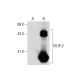 VILIP-2 Antibody (11B10) - Western Blotting - Image 58492 