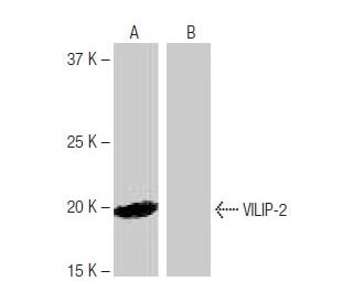 VILIP-2 Antibody (11B10) - Western Blotting - Image 65096 