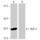 VILIP-2 Antibody (11B10) - Western Blotting - Image 65096 