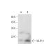 VILIP-2 Antibody (11B10) - Western Blotting - Image 70355