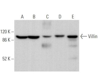 western blotting image from recommended Villin (1D2C3) monoclonal antibody replacement. Image 373932
