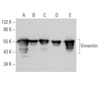 western blotting image from recommended Vimentin (V9) monoclonal antibody replacement. Image 361600