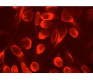 Vimentin Antibody (V9) | SCBT - Santa Cruz Biotechnology Vimentin Antibody (V9) | SCBT - Santa Cruz Biotechnology