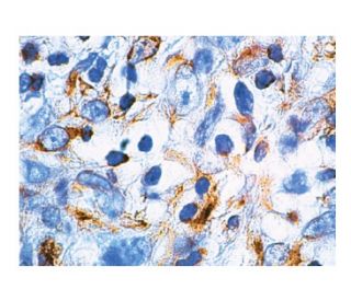 Vimentin Antibody (V9) | SCBT - Santa Cruz Biotechnology Vimentin Antibody (V9) | SCBT - Santa Cruz Biotechnology