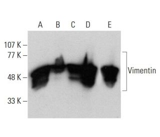 Vimentin Antibody (V9) | SCBT - Santa Cruz Biotechnology Vimentin Antibody (V9) | SCBT - Santa Cruz Biotechnology