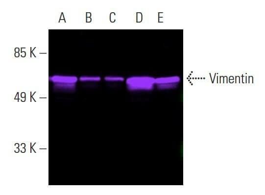 Vimentin Antibody (V9) | SCBT - Santa Cruz Biotechnology Vimentin Antibody (V9) | SCBT - Santa Cruz Biotechnology