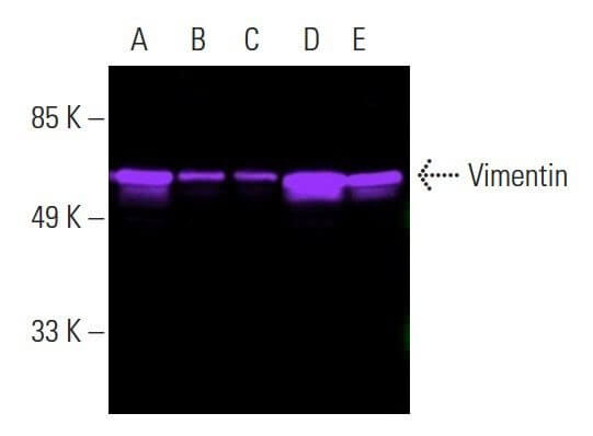 Vimentin Antibody (V9) | SCBT - Santa Cruz Biotechnology Vimentin Antibody (V9) | SCBT - Santa Cruz Biotechnology