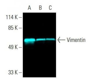 vimentin-antibody-v9-western- vimentin-antibody-v9-western-