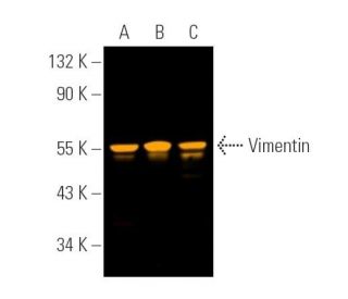 Vimentin Antibody (V9) | SCBT - Santa Cruz Biotechnology Vimentin Antibody (V9) | SCBT - Santa Cruz Biotechnology