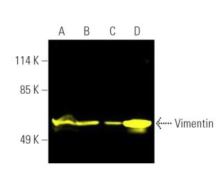 vimentin-antibody-v9-western- vimentin-antibody-v9-western-