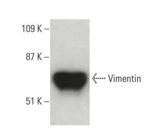 Vimentin Antibody (V9) | SCBT - Santa Cruz Biotechnology Vimentin Antibody (V9) | SCBT - Santa Cruz Biotechnology