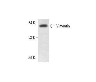 Vimentin Antibody (RV202) - Western Blotting - Image 12767
