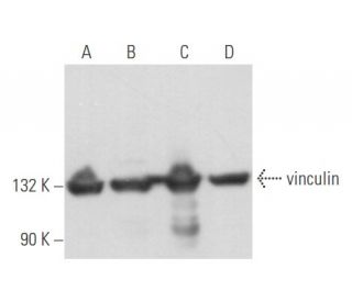 vinculin Antibody (2Q1087) - Western Blotting - Image 356688 