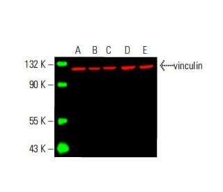 vinculin Antibody (7F9) - Western Blotting - Image 395843 