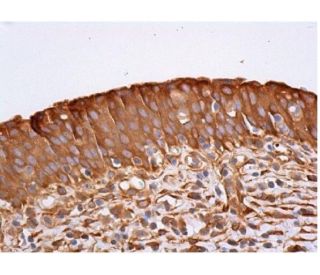 immunohistochemistry image from recommended vinculin (7F9) monoclonal antibody replacement. Image 353932