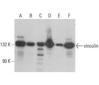 vinculin Antibody G 11 SCBT Santa Cruz Biotechnology