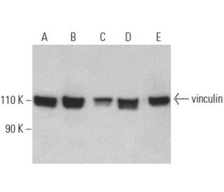 vinculin Antibody (G-11) - Western Blotting - Image 400055 