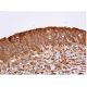 immunohistochemistry image from recommended vinculin (7F9) monoclonal antibody replacement. Image 353932