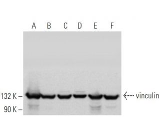 vinculin Antibody (V284) - Western Blotting - Image 373437 